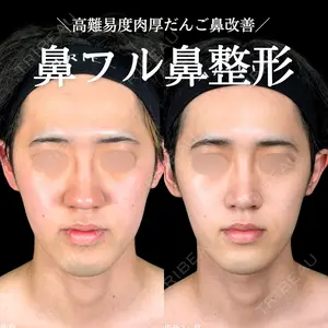 症例