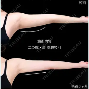 症例