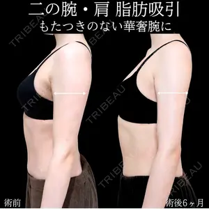 症例