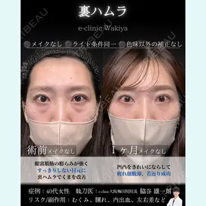 症例