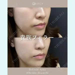 症例