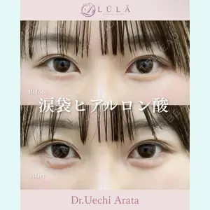 症例