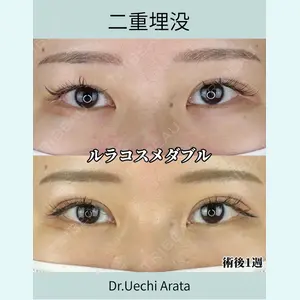 症例
