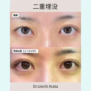 症例