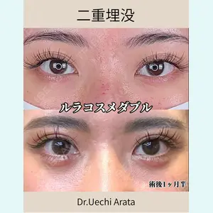 症例