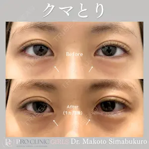 症例