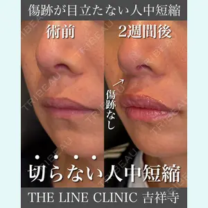 症例