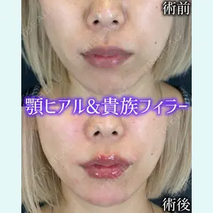 症例