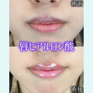 症例