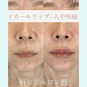 症例