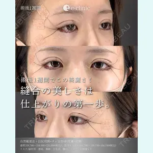 症例
