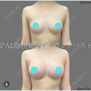 症例