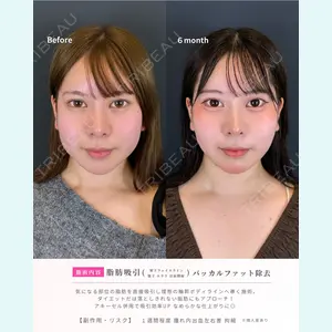 症例