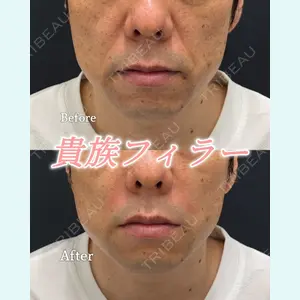 症例