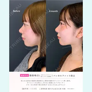 症例