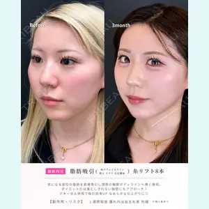 症例