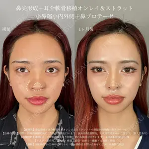 症例
