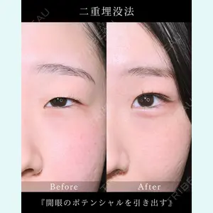 症例