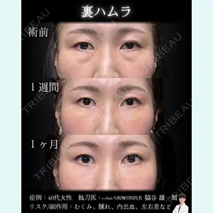 症例