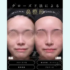 症例