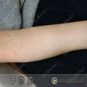 きずときずあとのクリニック 豊洲院 村松 英之医師の症例