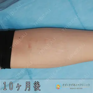 きずときずあとのクリニック 豊洲院 村松 英之医師の症例