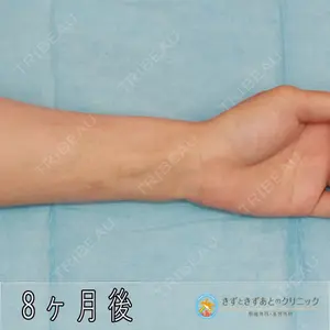 きずときずあとのクリニック 豊洲院 村松 英之医師の症例