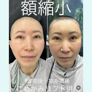 症例