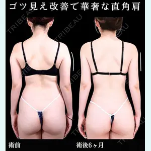 症例