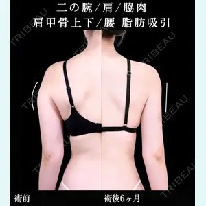 症例