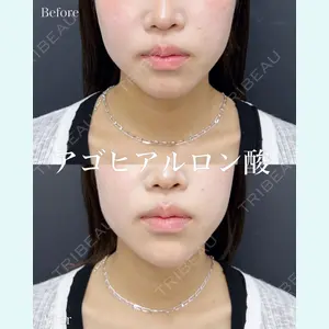 症例