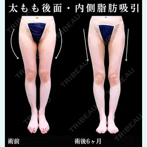 症例