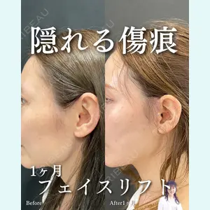 症例