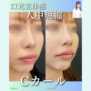症例