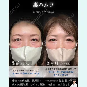 症例