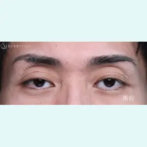 症例