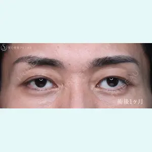 症例