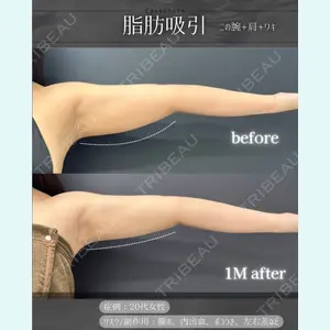 症例