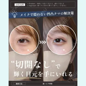 症例