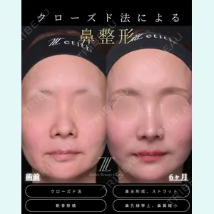症例