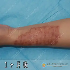 きずときずあとのクリニック 豊洲院 村松 英之医師の症例