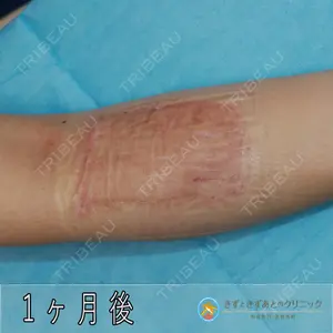 きずときずあとのクリニック 豊洲院 村松 英之医師の症例