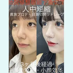 症例