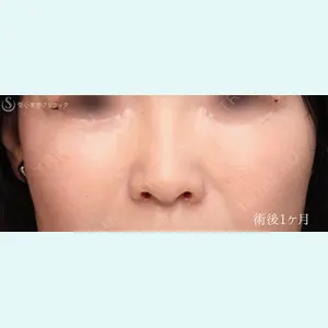 症例