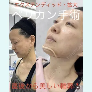 症例