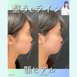 症例