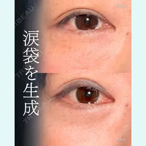 症例
