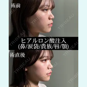 症例