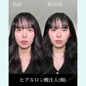症例