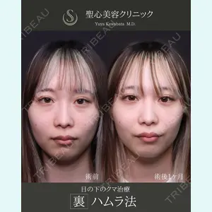 症例